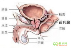 前列腺增生